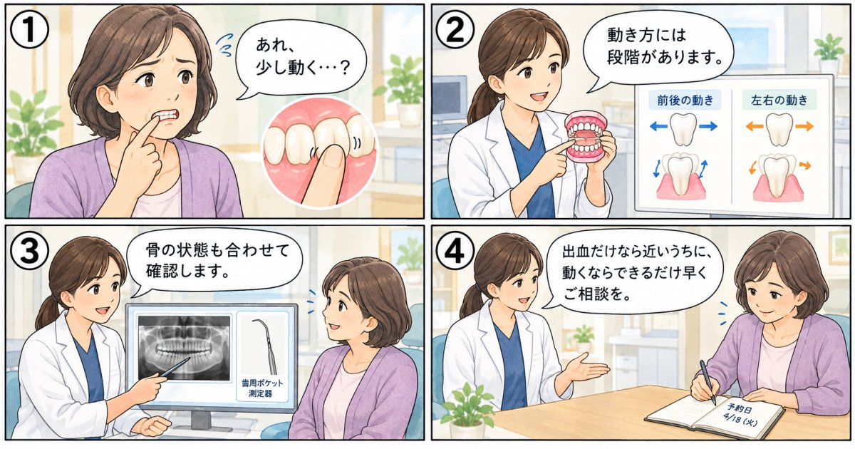 歯を指で押すと動く場合、進行はどの段階まで進んでいるか